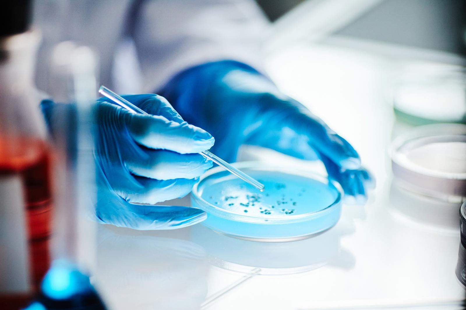 Behandschuhte Hände geben mit einer Pipette Flüssigkeit in eine Petrischale